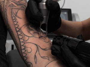 usuwanie tatuażu Łódź – zabieg w studio FADE AWAY