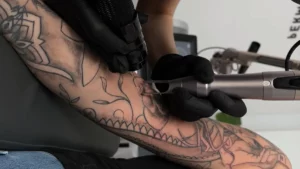usuwanie tatuażu Łódź – zabieg w studio FADE AWAY
