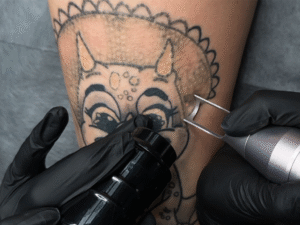 usuwanie tatuażu Łódź – zabieg w studio FADE AWAY